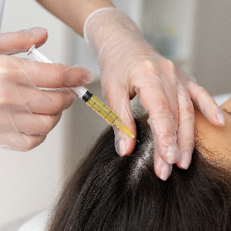 Hair Fall