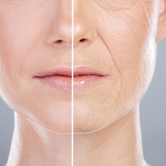 Anti-Aging